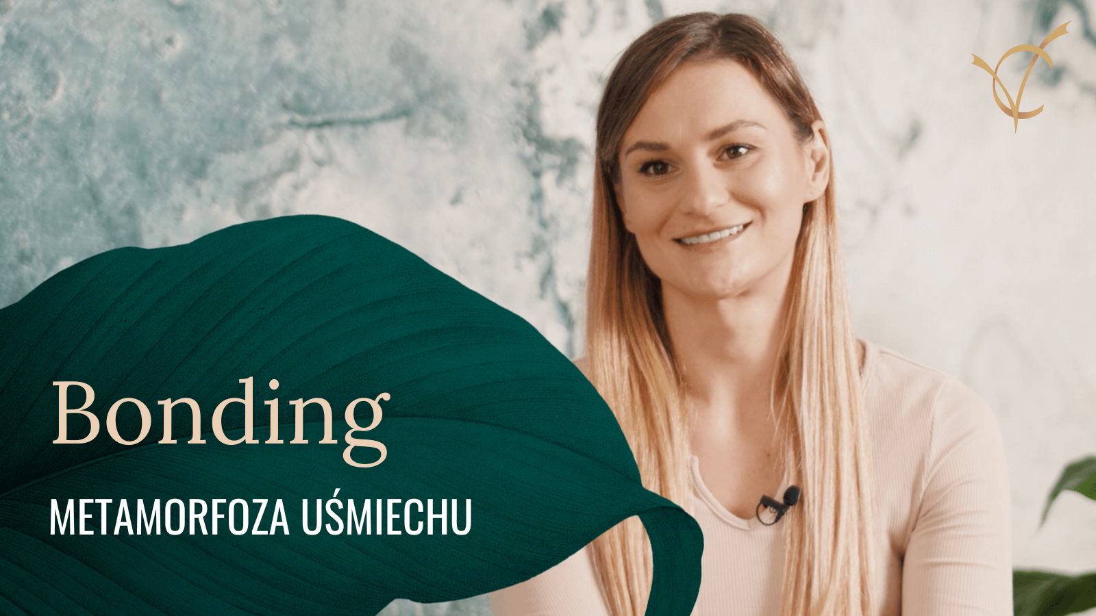 Bonding - metamorfoza uśmiechu w #VerdeClinic