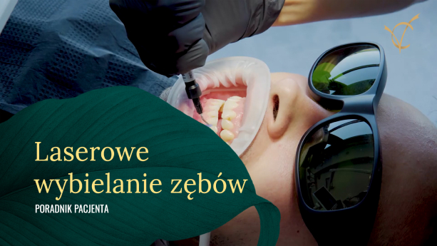 Laserowe wybielanie zębów <br>PORADNIK PACJENTA